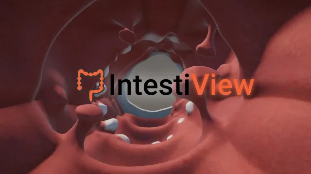 IntestiView